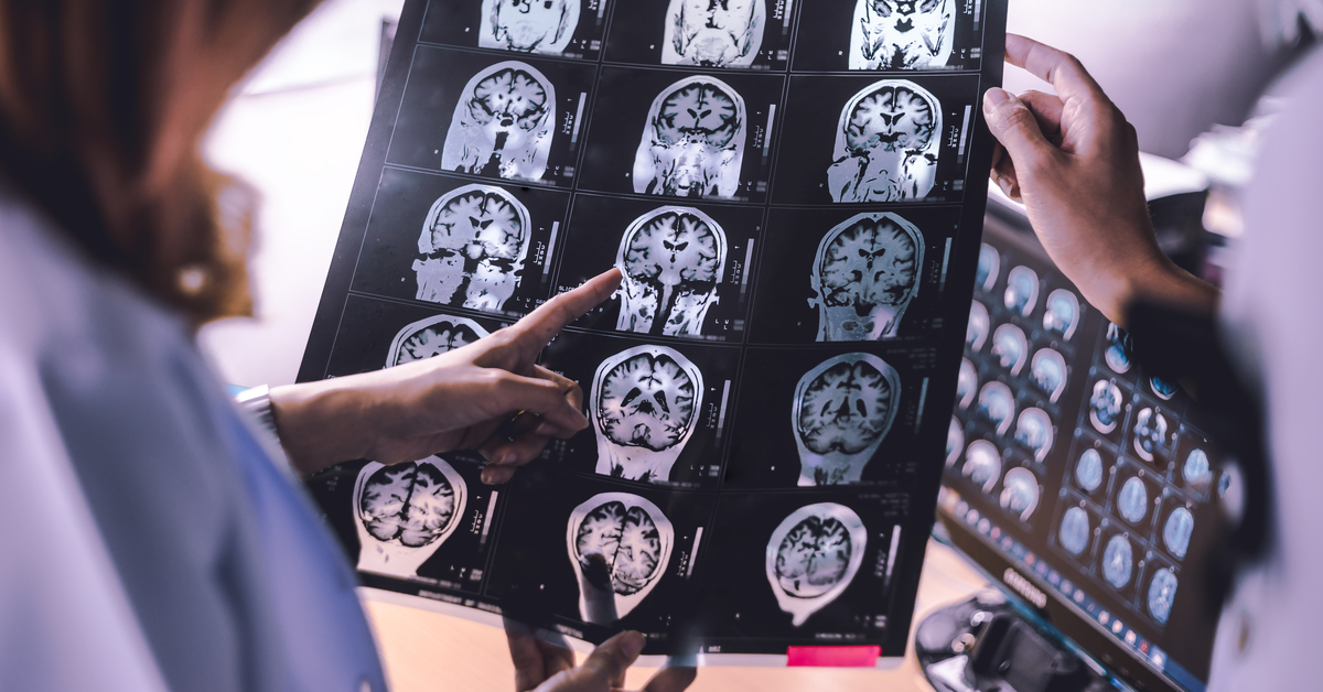 Araştırmalara göre, uykunun REM evresine geçişte zorlanmak Alzheimer belirtisi olabilir