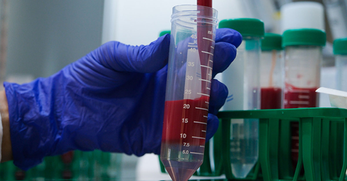 Hitit ve Maryland üniversiteleri KKKA aşısı üzerinde ortak çalışma yapıyor