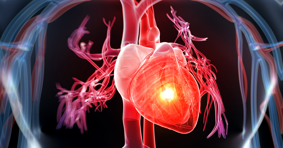 Kalp krizi sonrası ölümlerde AB birincisiyiz